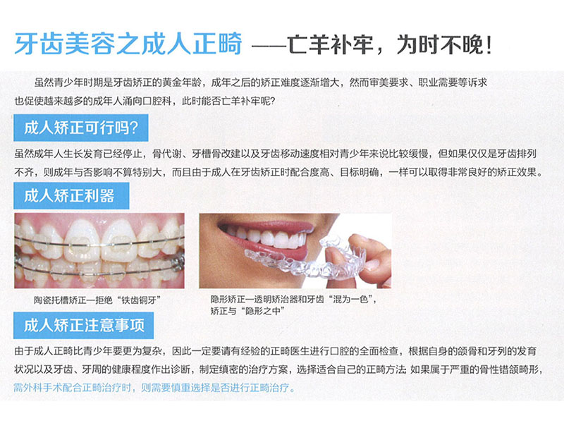 成人正畸