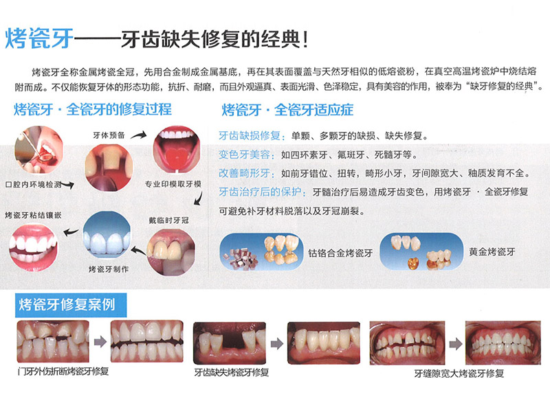 牙齿修复